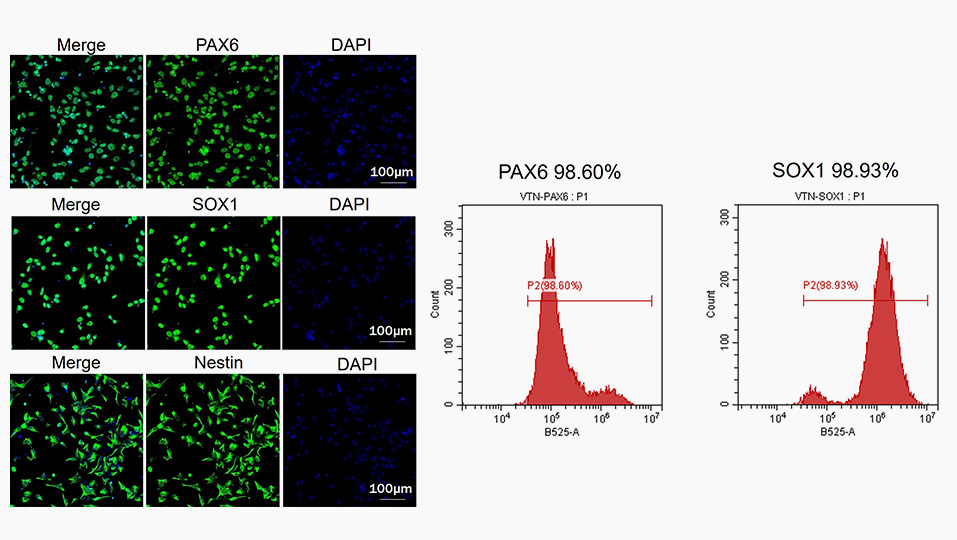 Shh and Noggin for iPSC differentiation