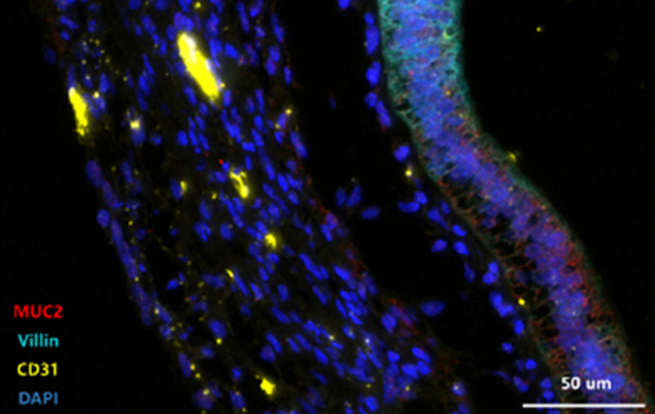 Immunostaining of Intestinal Organoid