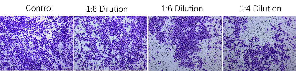 Tumor Cell Invasion