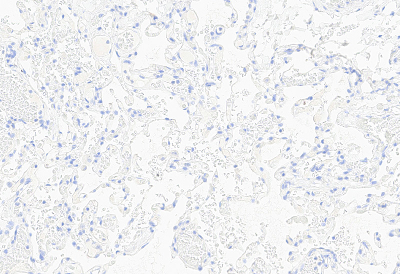 Immunohistochemistry (Formalin/PFA-fixed paraffin-embedded sections) -Recombinant Monoclonal Anti-Claudin-18.2 Antibody, Mouse (3B10) (HCS-S278)Human Lung Tissue, 20X