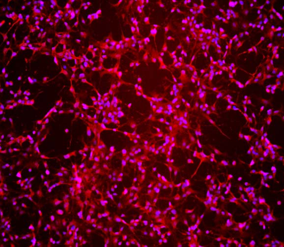  Tbr1 IMMUNOSTAINING