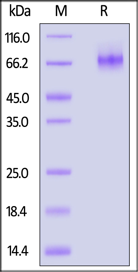 ADAM9 SDS-PAGE