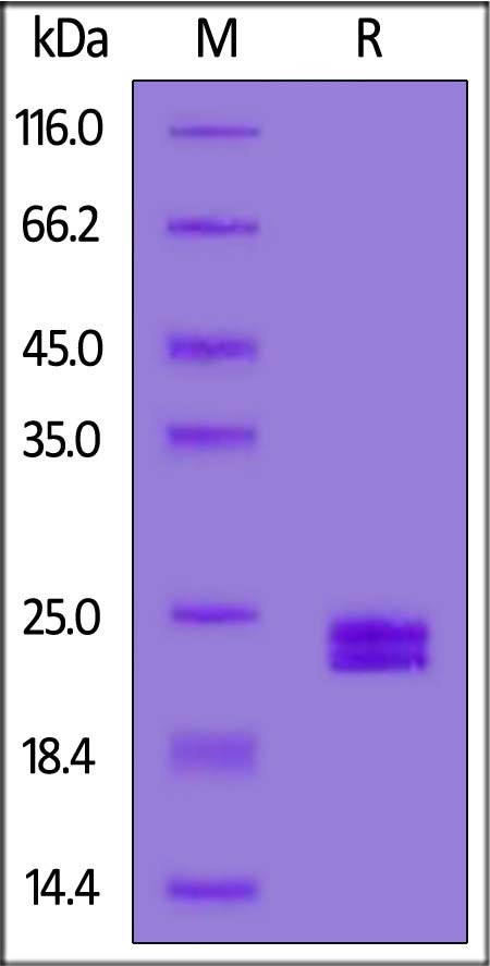 Mouse AGR2, His Tag (Cat. No. AG2-M52H6) SDS-PAGE gel