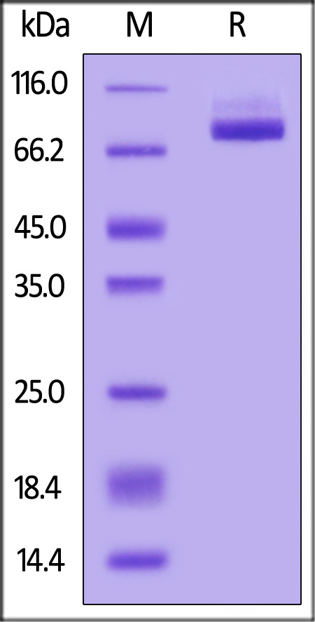 Mouse APLP2, His Tag (Cat. No. AP2-M52H9) SDS-PAGE gel