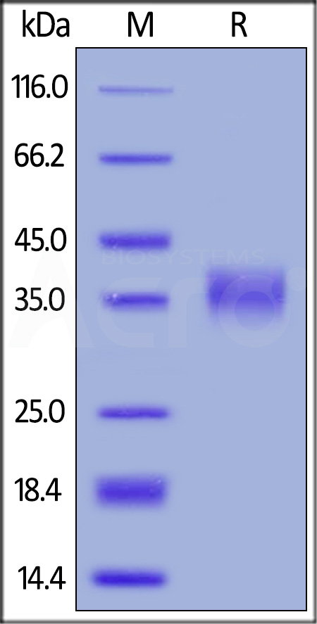 Human Azurocidin, His Tag (Cat. No. AZ1-H5225) SDS-PAGE gel