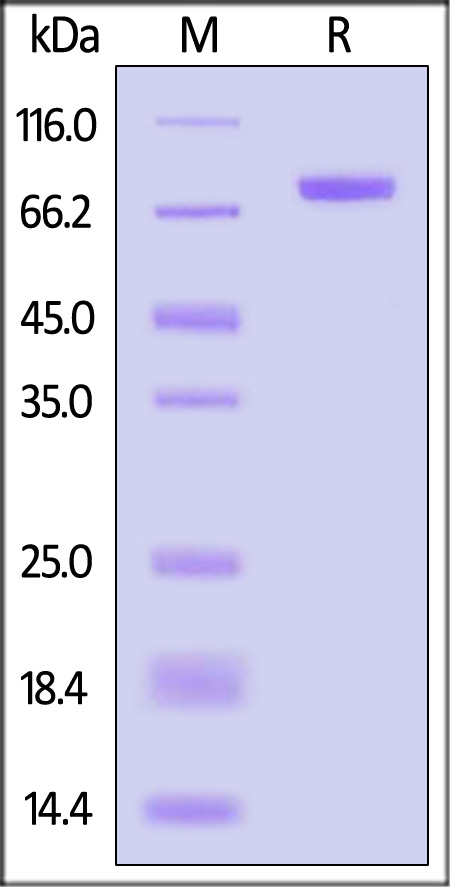 beta-Glucuronidase/GUSB SDS-PAGE