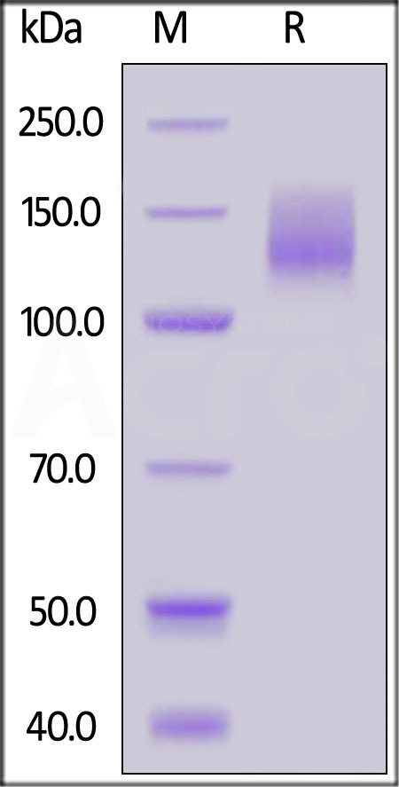 CA125 SDS-PAGE