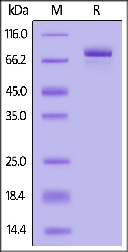 Carbonic Anhydrase IX SDS-PAGE