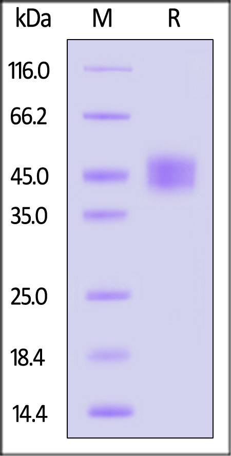 Carbonic Anhydrase XII SDS-PAGE