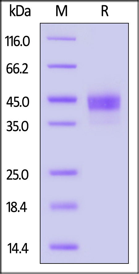 Carbonic Anhydrase XII SDS-PAGE