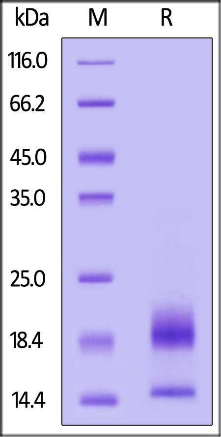 Human CCL7, His Tag (Cat. No. CC7-H52H6) SDS-PAGE gel