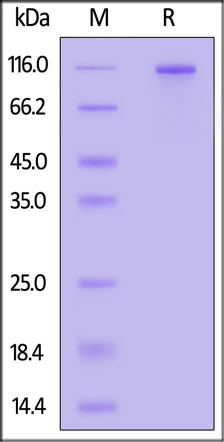 Human Complement Receptor type 2 Protein, His Tag (Cat. No. CD2-H52H4) SDS-PAGE gel