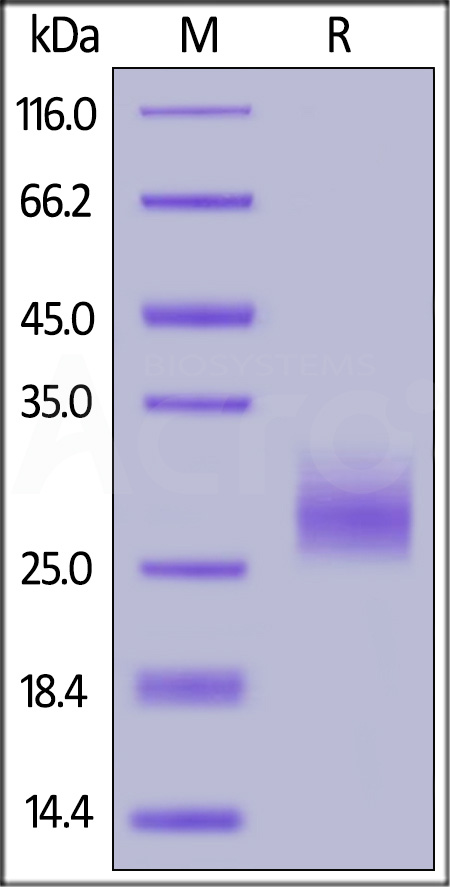 Human LAIR-1, His Tag (Cat. No. CD5-H52H1) SDS-PAGE gel