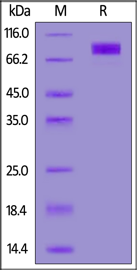 CD117 SDS-PAGE