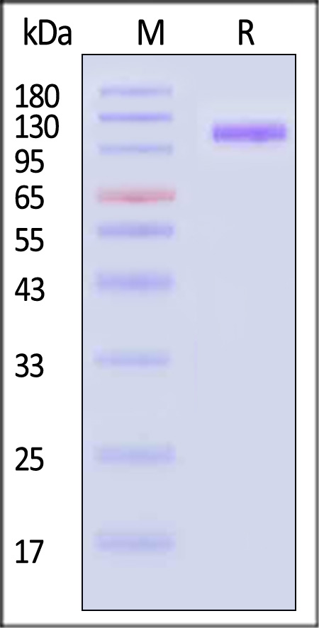 CD117 SDS-PAGE