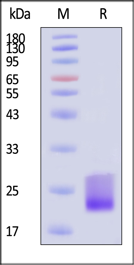 Human CD69, His Tag (Cat. No. CD9-H5222) SDS-PAGE gel