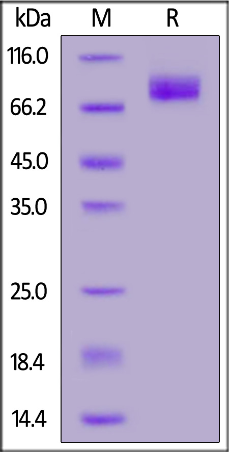 Human E-Selectin, His Tag (Cat. No. CDE-H5222) SDS-PAGE gel