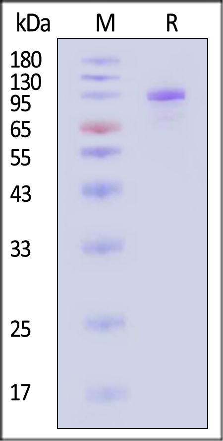 Complement C2 SDS-PAGE