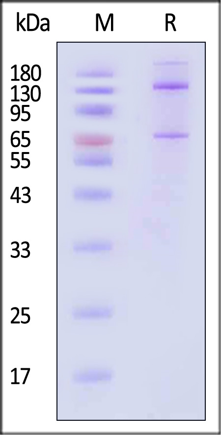 Complement C5 SDS-PAGE