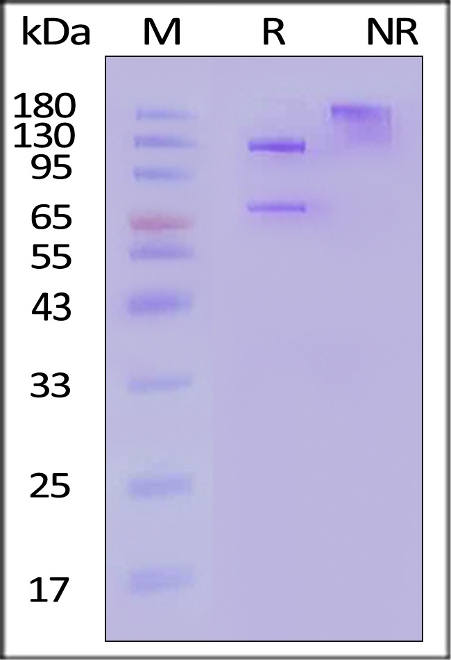 Complement C5 SDS-PAGE