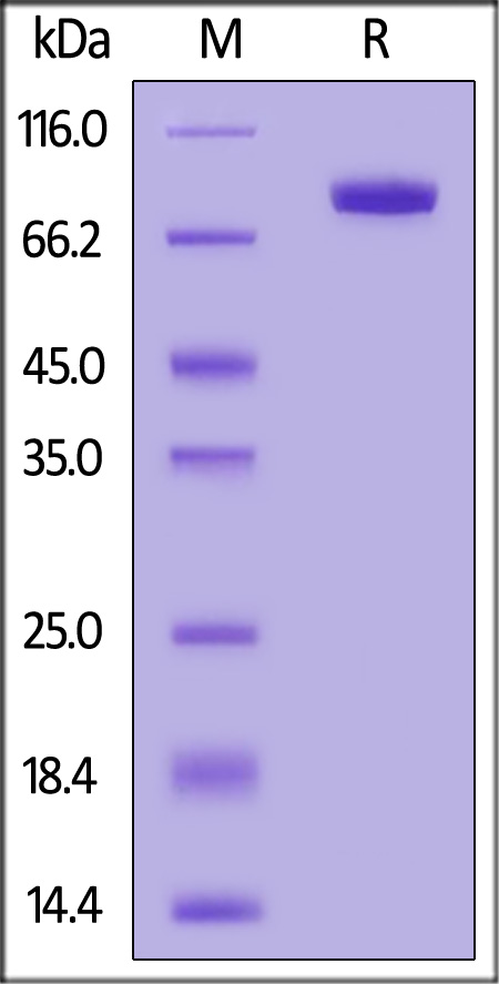 Human DDR1, Fc Tag (Cat. No. DD1-H5258) SDS-PAGE gel