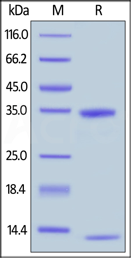 FcRn (FCGRT & B2M) SDS-PAGE