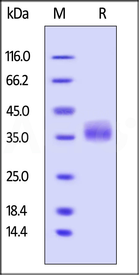 Human Galectin-3, His Tag (Cat. No. GA3-H5247) SDS-PAGE gel