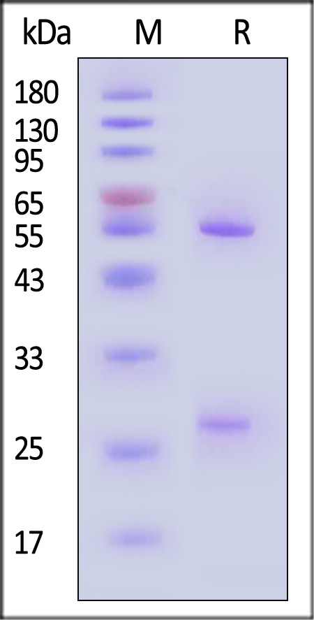 Hemagglutinin/HA (Influenza Virus) SDS-PAGE