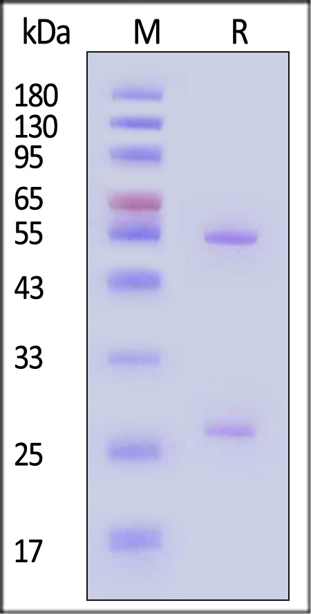 Hemagglutinin/HA (Influenza Virus) SDS-PAGE