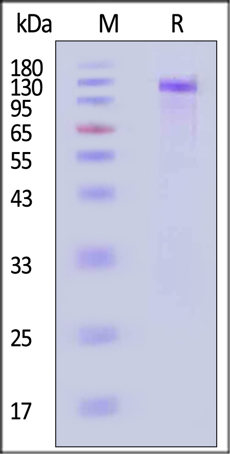 Her2 SDS-PAGE