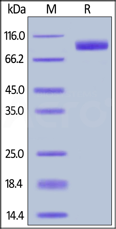 Her2 SDS-PAGE