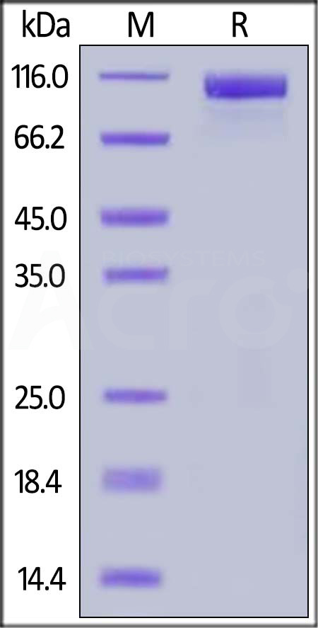 Her2 SDS-PAGE