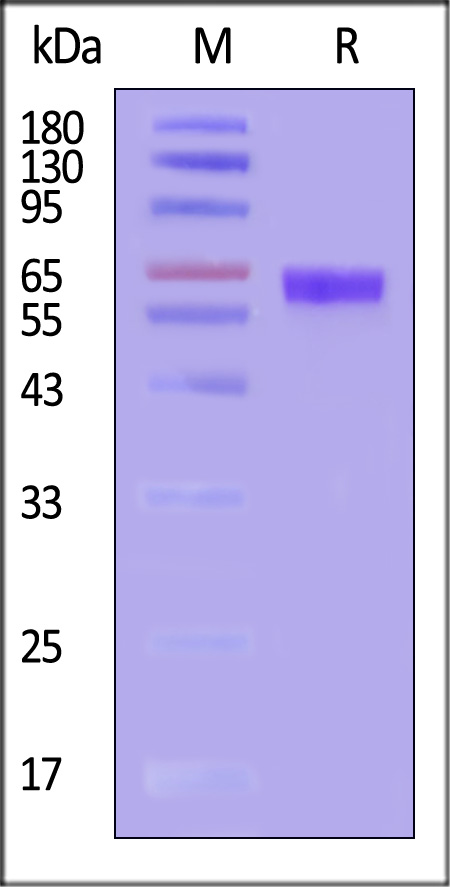 Her2 SDS-PAGE