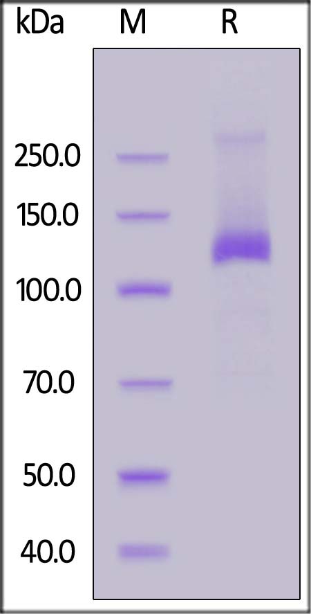 Her2 SDS-PAGE