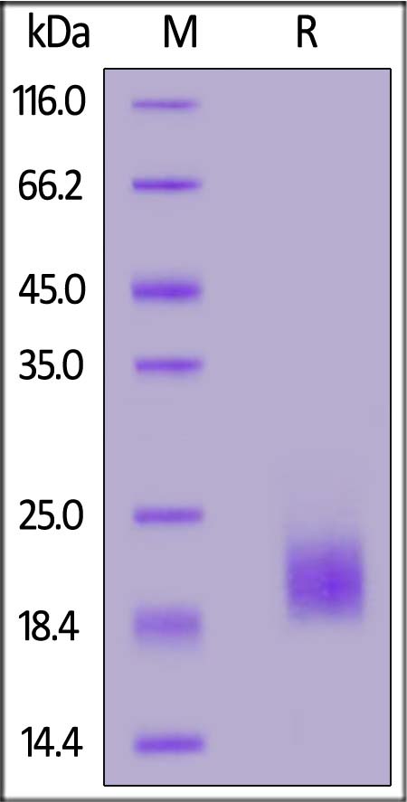 Human HE4, His Tag (Cat. No. HE4-H5223) SDS-PAGE gel