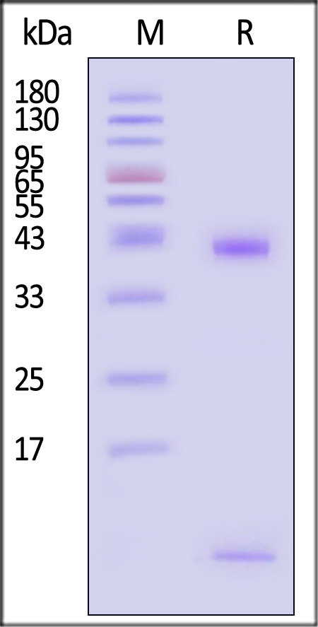 HLA-A*0201 & B2M & PSMA (MMNDQLMFL) SDS-PAGE