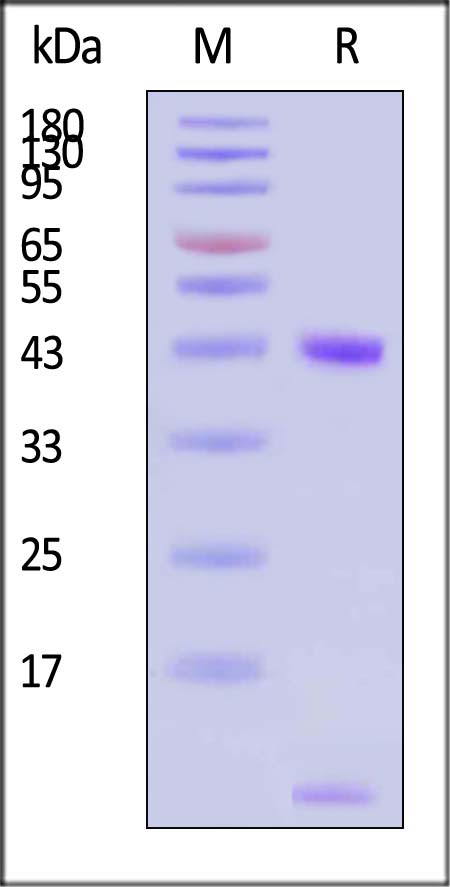 HLA-A*0201 & B2M & EBV EBNA (FMVFLQTHI) SDS-PAGE