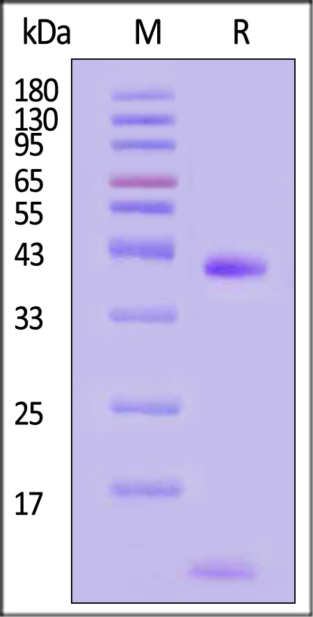 HLA-A*2402 & B2M & EBV EBNA3B (TYSAGIVQI) SDS-PAGE