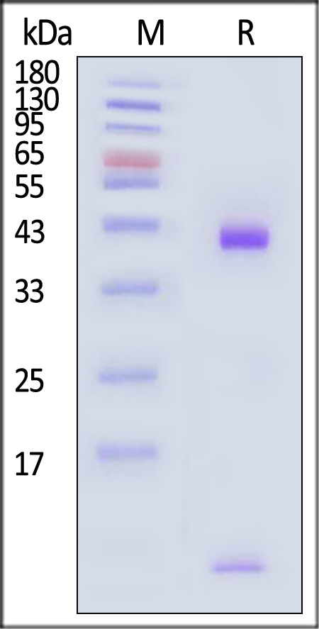 HLA-A*1101 & B2M & KRASG12C (VVVGACGVGK) SDS-PAGE