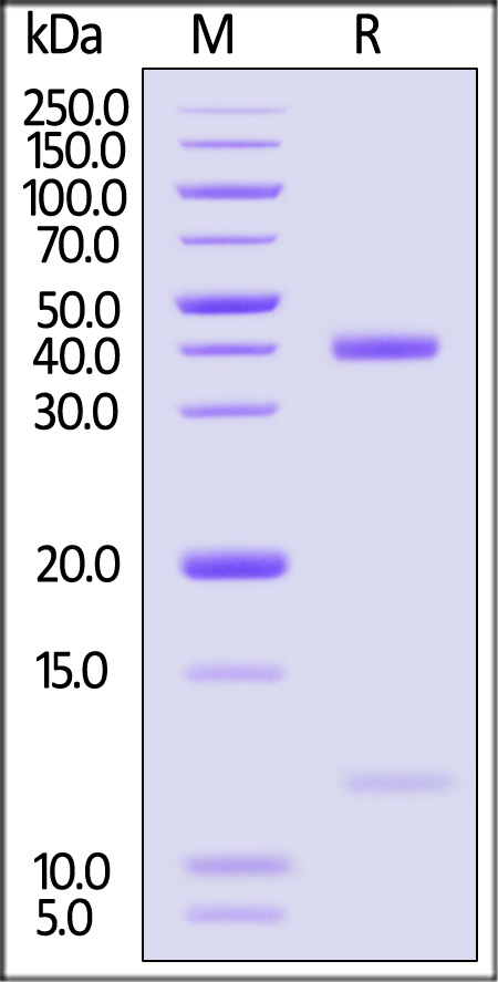 HLA-A*1101 & B2M & KRASG12D (VVVGADGVGK) SDS-PAGE