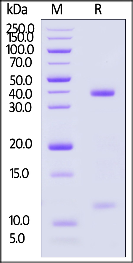 HLA-A*1101 & B2M & EBV (AVFDRKSDAK) SDS-PAGE