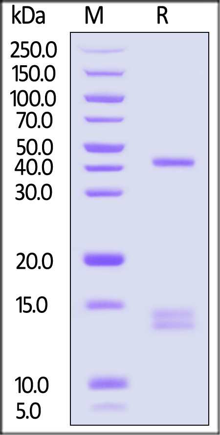 HLA-A*02:01 & B2M & Glypican 3 SDS-PAGE