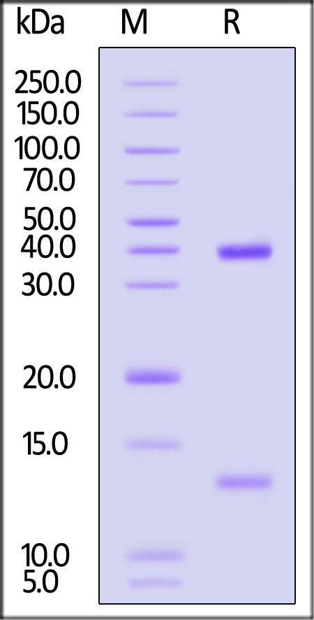 HLA-A*02:01 & B2M & Glypican 3 SDS-PAGE