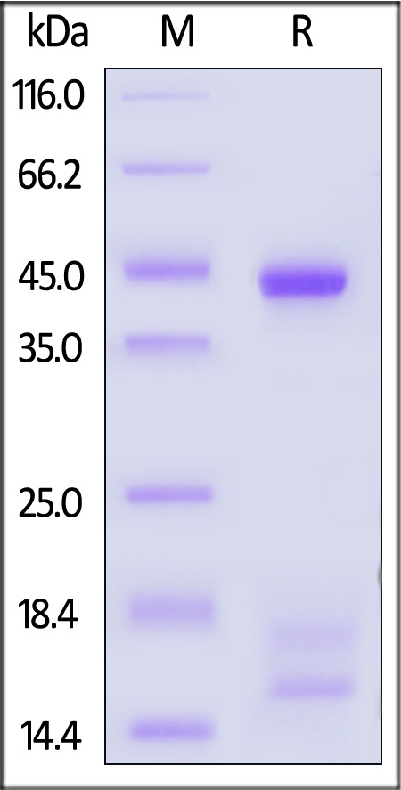 HLA-A*02:01 & B2M & gp100 SDS-PAGE