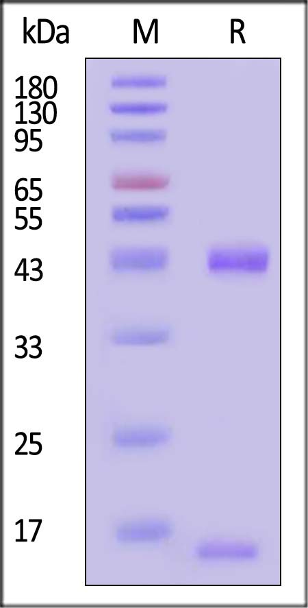 HLA-A*0301 & B2M SDS-PAGE