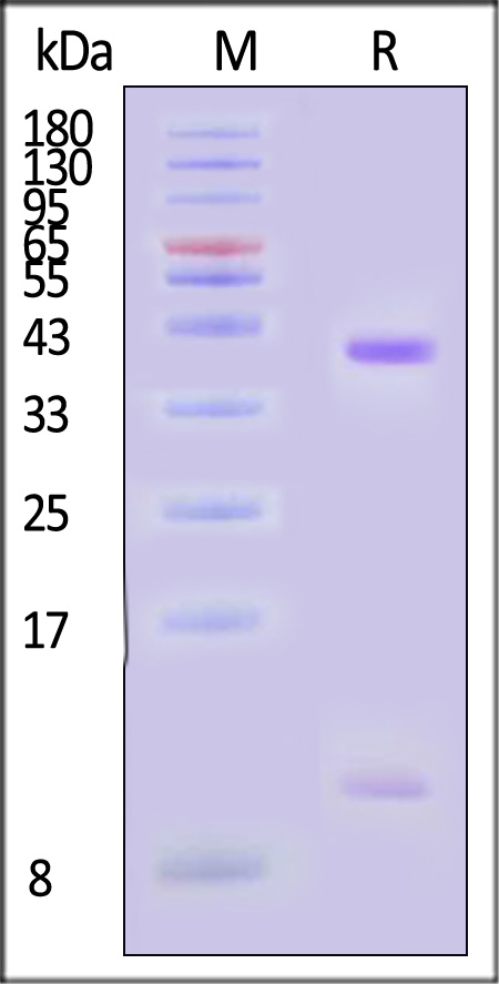 HLA-A*0201 | B2M SDS-PAGE