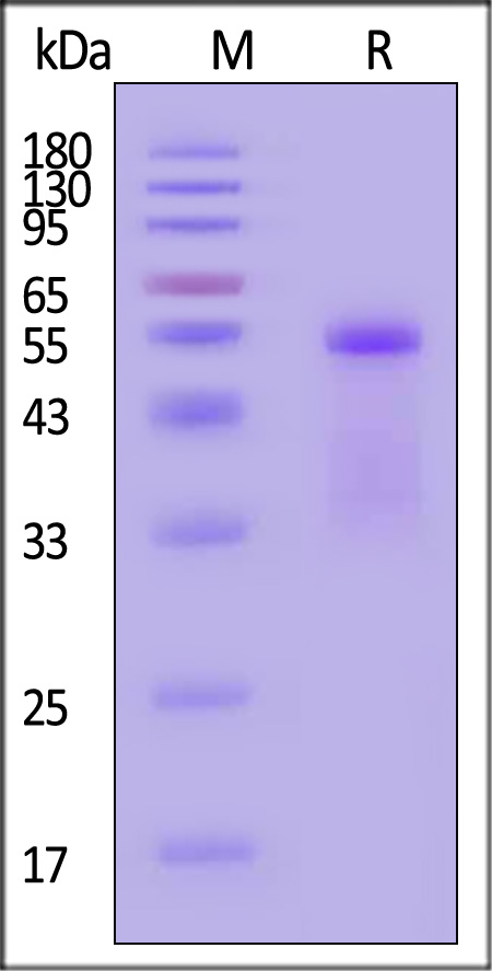 HLA-A*0101 & B2M SDS-PAGE