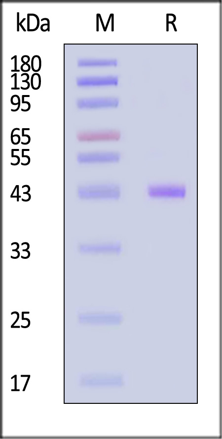 HLA-A*0201 & B2M & hTERT (ILAKFLHWL) SDS-PAGE