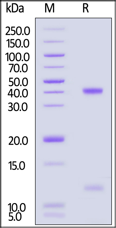 HLA-A*0201 | B2M | HBV SDS-PAGE