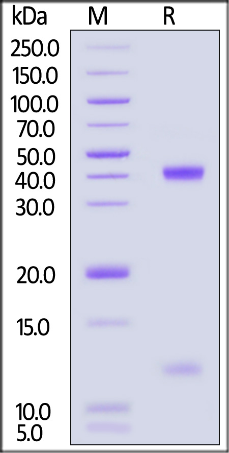 HLA-A*0201 | B2M | HBV SDS-PAGE